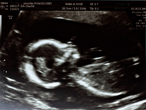 16 week ultrasound