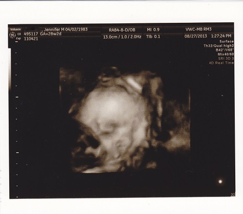 baby 4D scan
