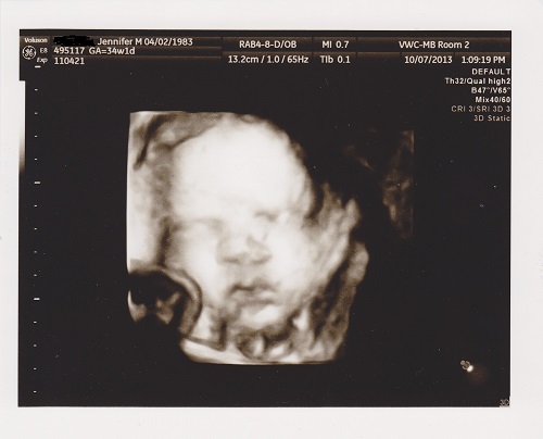Baby NoYoMoCo